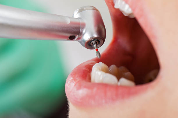 Best Emergency Broken Tooth Repair in St Andrews, SC